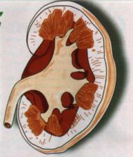 rinichi.jpg (10747 bytes)