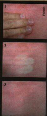 vara fierbinte.jpg (8010 bytes)